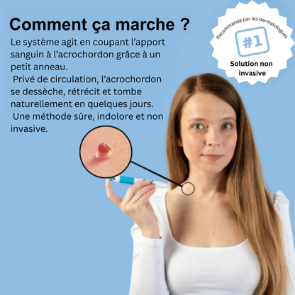 TagBuddy – Kit pour enlever les petites boules de peau